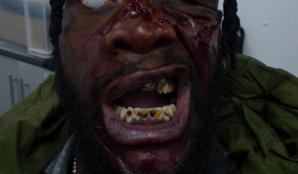 'Day Of Reckoning' Boxing Promo